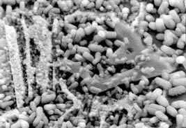 Magnified Cryogenic-treated